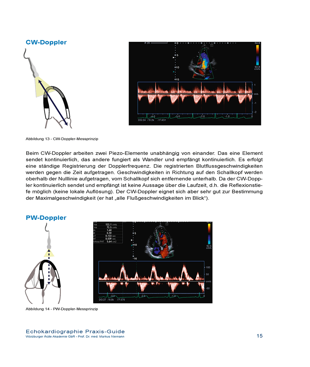 Praxisguide – CW- und PW-Doppler