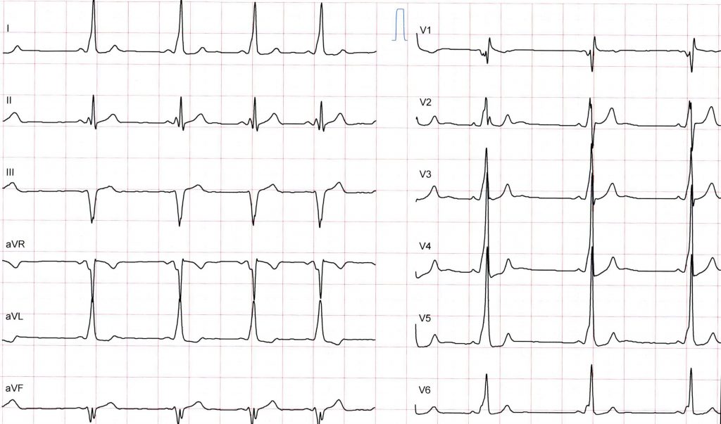EKG Kurs